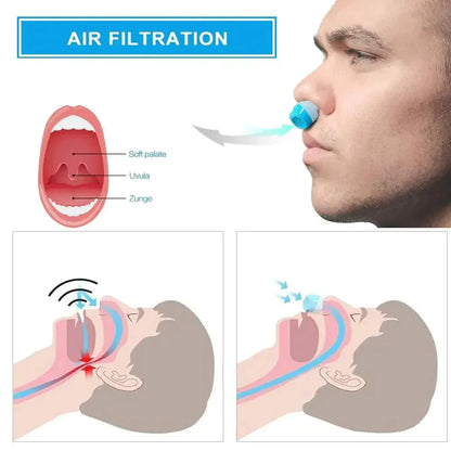 Micro CPAP Alternative | Portable Anti-Snoring & Sleep Apnea Solution – CPAP Alternative