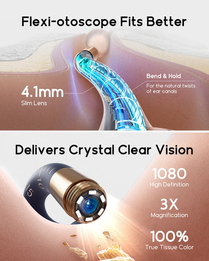 Bebird EarSight Plus I35R – All-in-1 HD Visual Ear Camera & Cleaning Tool — View 5
