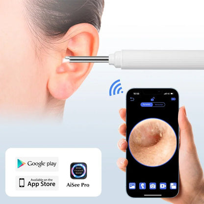 5MP HD Visual Ear Scope with LED Light – Digital Ear Inspection Camera — View 7