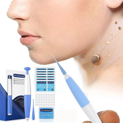 Micro Auto Precision Skin Spot Pen – 1 - Step Home Beauty Kit - GiftWave.co