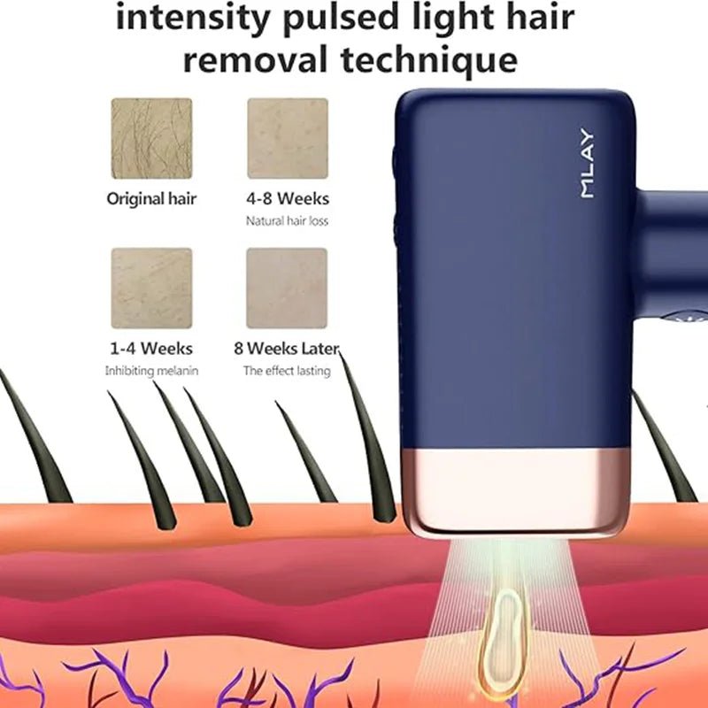 MLAY T14 IPL Hair Removal Device 0.5s Flash Replaceable Lamp Ice Cooling Permanent Epilator Men Women - GiftWave.co