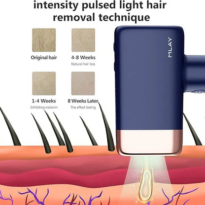 MLAY T14 IPL Hair Removal Device 0.5s Flash Replaceable Lamp Ice Cooling Permanent Epilator Men Women - GiftWave.co