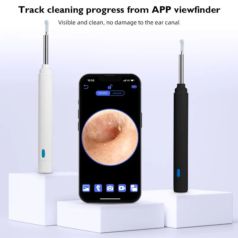 5MP HD Visual Ear Scope with LED Light – Digital Ear Inspection Camera — View 5