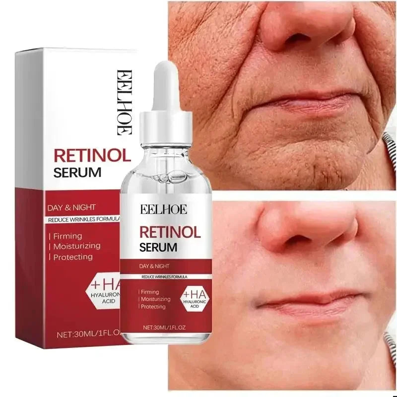 RevitLift™ Retinol Pro-Enrichment Kit | Advanced Firming & Fine Line Recovery