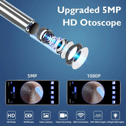 5MP HD Visual Ear Scope with LED Light – Digital Ear Inspection Camera — View 4